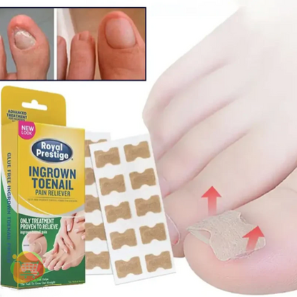 50 Parches FreeNail™ - Correctores para Uñas Encarnadas y Hongos